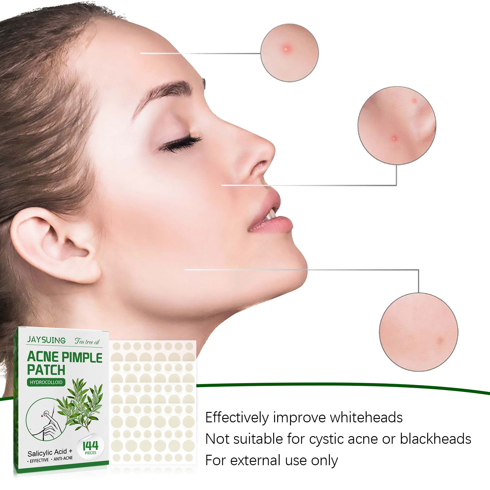 Hydrocolloid acne pimple patches with Tea Tree Oil